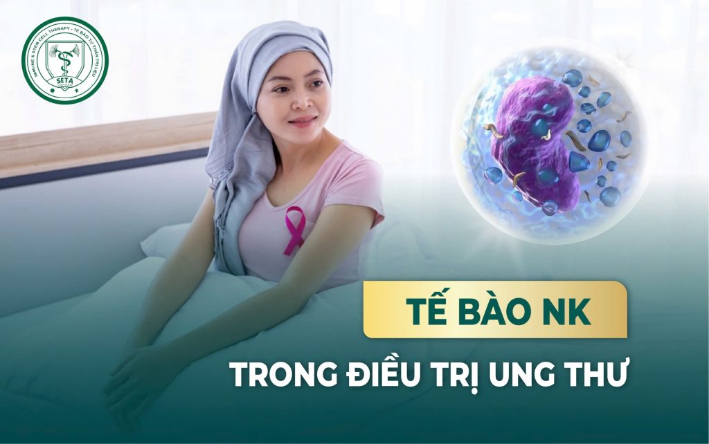 Tế Bào NK Trong Cuộc Chiến Chống Ung Thư Tế Bào NK Trong Cuộc Chiến Chống Ung Thư