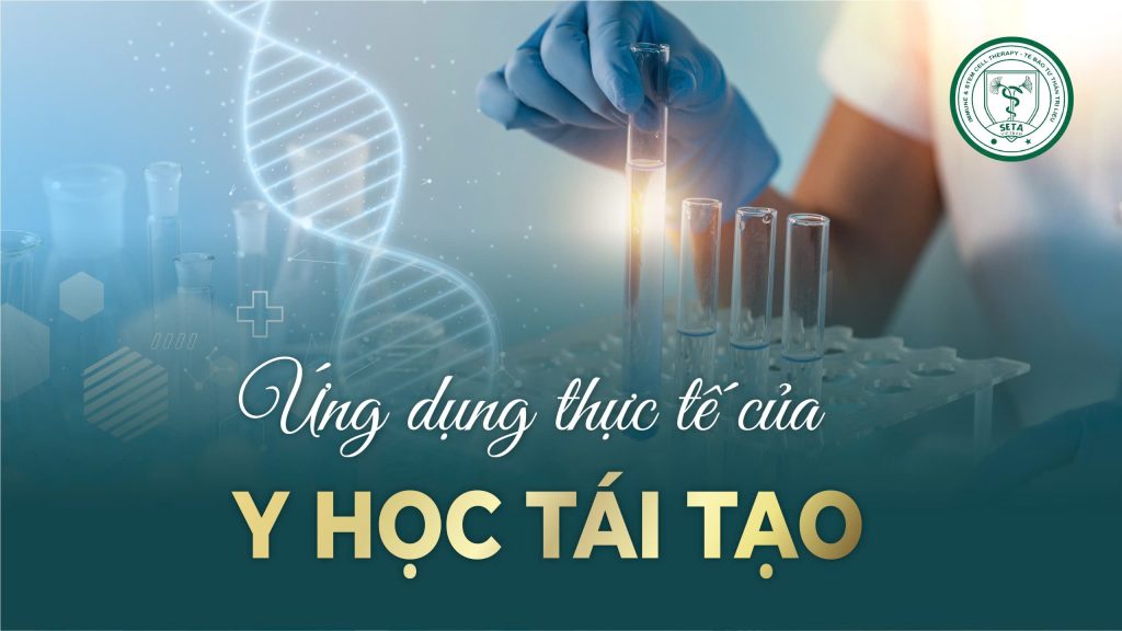 Y Học Tái Tạo: Xu Hướng Chăm Sóc Sức Khỏe Toàn Diện
