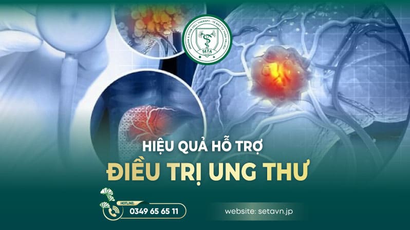 Liệu Pháp Tế Bào Miễn Dịch Tự Thân