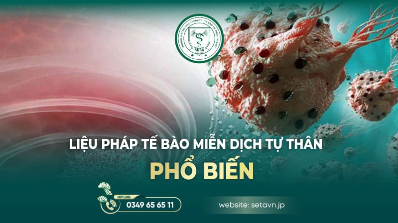 Tư Vấn Về Ưu Điểm Của Liệu Pháp Tế Bào Miễn Dịch Tự Thân Trong Điều Trị Ung Thư 9 Liệu pháp tế bào miễn dịch tự thân phổ biến - SETA Việt Nam