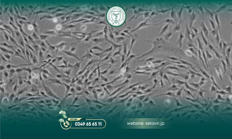 Nuôi Cấy Tế Bào Sợi Trong Y Học Hiện Đại 9 Tế bào sợi nuôi cấy - SETA Việt Nam