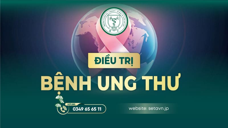 Bệnh ung thư – Tổng quan từ nguyên nhân đến phương pháp điều trị hiệu quả 11 Tổng quan bệnh ung thư - Cách điều trị