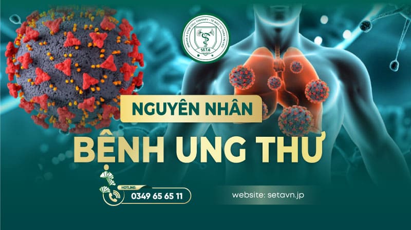 Bệnh ung thư – Tổng quan từ nguyên nhân đến phương pháp điều trị hiệu quả 10 Tổng quan bệnh ung thư - Nguyên nhân