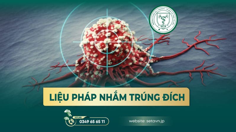 Điều Trị Ung Thư Bằng Thuốc - SETA Việt Nam