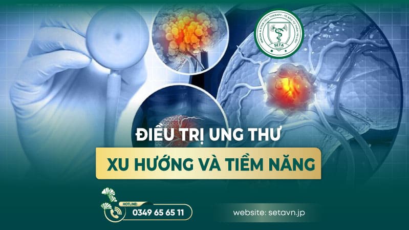 Liệu pháp tế bào miễn dịch T kết hợp hoá trị & xạ trị - SETA Việt Nam
