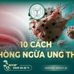 10 Cách Phòng Ngừa Ung Thư Hiệu Quả Ngay Từ Hôm Nay 4 Phòng ngừa ung thư - SETA Việt Nam