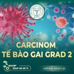 Carcinom Tế Bào Gai Grad 2 Là Gì? Tìm Hiểu Về Tế Bào Gai Và Vai Trò Của Lympho Bào 6 Carcinom Tế Bào Gai Grad 2