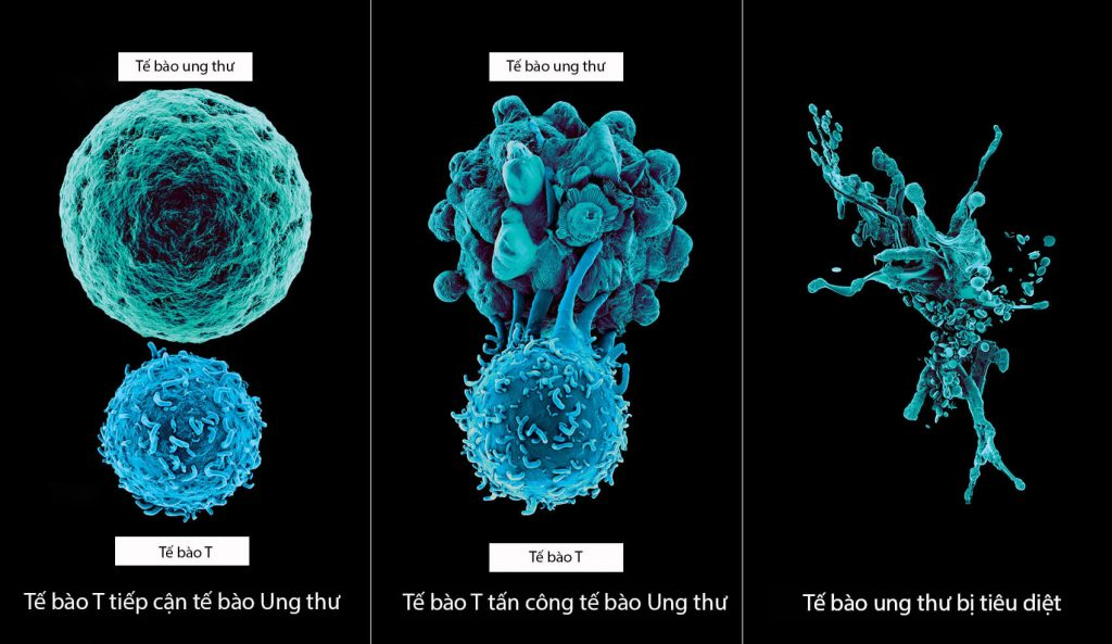 Liệu pháp miễn dịch tế bào T: Hy vọng mới trong điều trị ung thư 15 Liệu pháp miễn dịch tế bào T